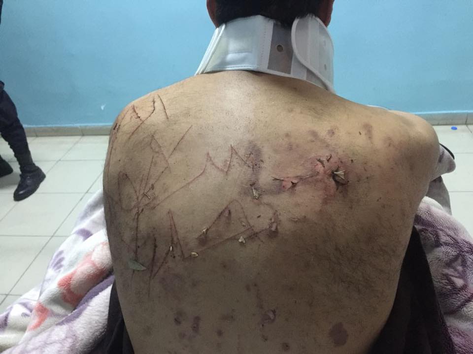 آثار التعذيب على جسد الأمين العام لمنظمة مؤمنون بلا حدود